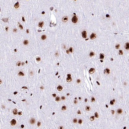 ARID1A Recombinant Rabbit mAb (S-440-62)
