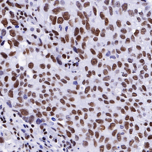 Ku80 Recombinant Rabbit mAb (S-R226)