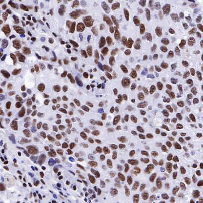 Ku80 Recombinant Rabbit mAb (S-R226)