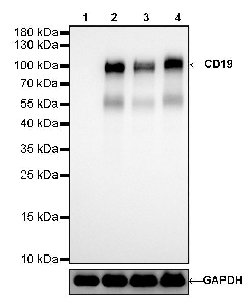 CD19 Recombinant Rabbit mAb (SDT-164-33)