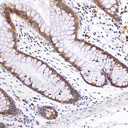 NTSR1 Recombinant Rabbit mAb (S-4844-38)