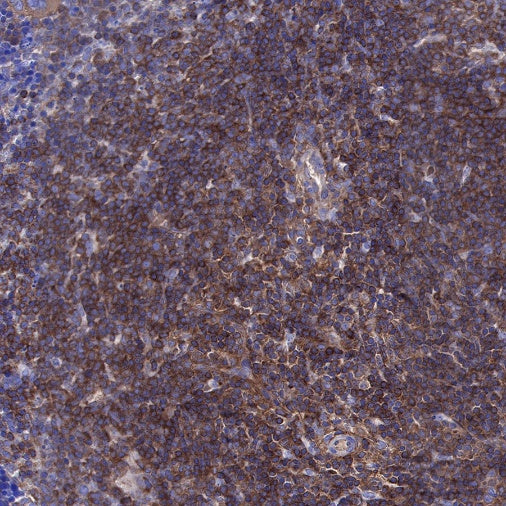 NF-κB p65 Recombinant Rabbit mAb (S-475-56)