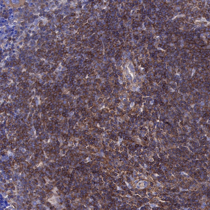 NF-κB p65 Recombinant Rabbit mAb (S-475-56)