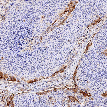VISTA Recombinant Rabbit mAb (S-1013-5)