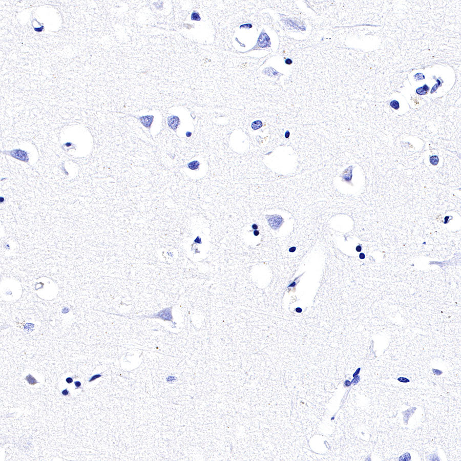 CGA/HCG-α Recombinant Rabbit mAb (SDT-227-66)