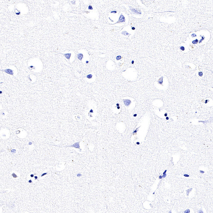 CGA/HCG-α Recombinant Rabbit mAb (SDT-227-66)