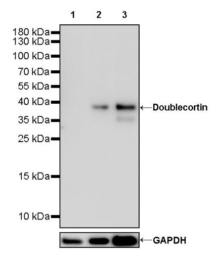 Doublecortin Recombinant Rabbit mAb (S-1234-3)