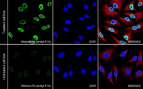 Histone H3 (acetyl K14) Recombinant Rabbit mAb (S-R398)