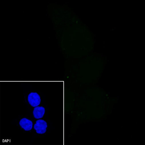 PMS2 Recombinant Rabbit mAb (SDT-111-307)