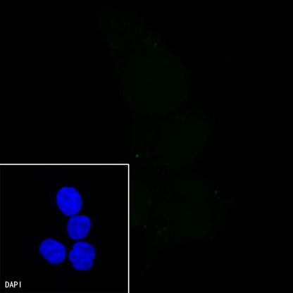 PMS2 Recombinant Rabbit mAb (SDT-111-307)