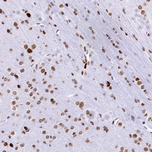 HAT1 Recombinant Rabbit mAb (S-2429-14)