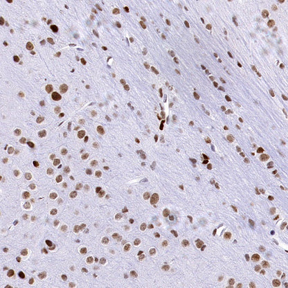 HAT1 Recombinant Rabbit mAb (S-2429-14)