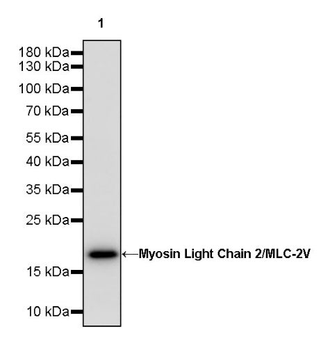 Myosin Light Chain 2/MLC-2V Rabbit Polyclonal Antibody