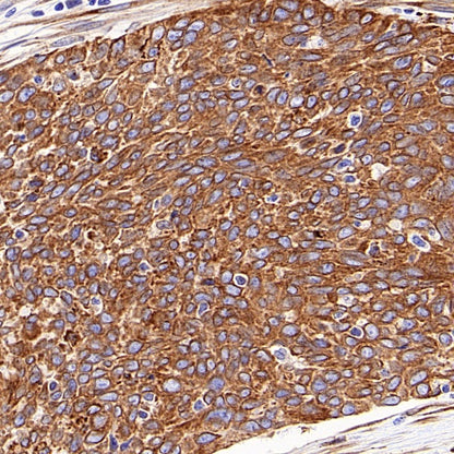 SERCA2 ATPase Recombinant Rabbit mAb (S-5956)