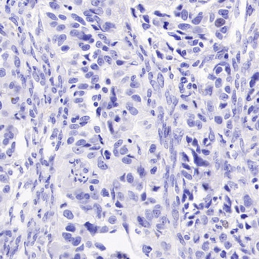 LPA Rabbit Polyclonal Antibody
