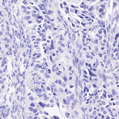 LPA Rabbit Polyclonal Antibody