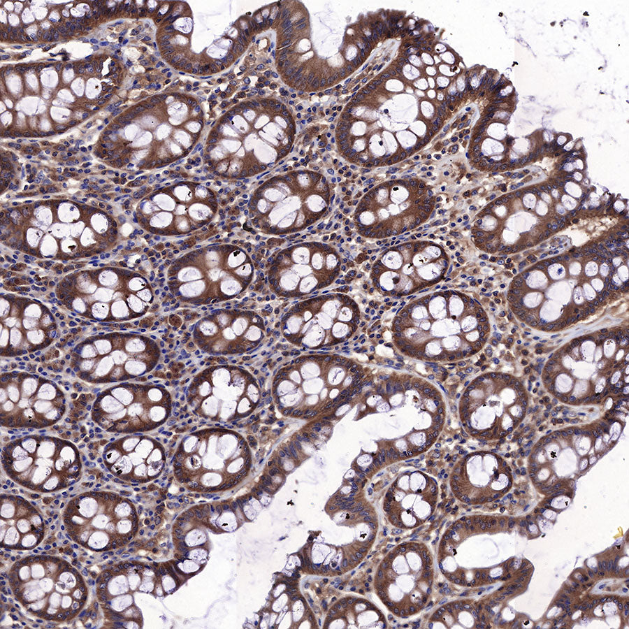 AMPKα Recombinant Rabbit mAb (S-455-38)