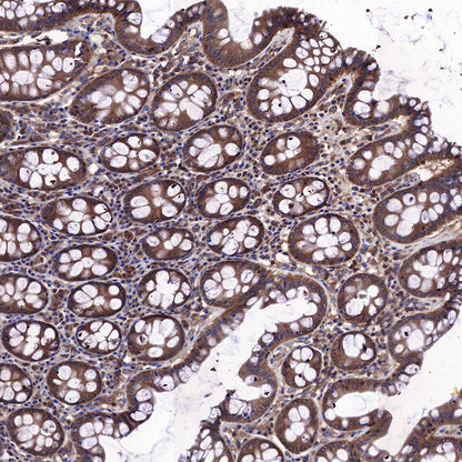 AMPKα Recombinant Rabbit mAb (S-455-38)