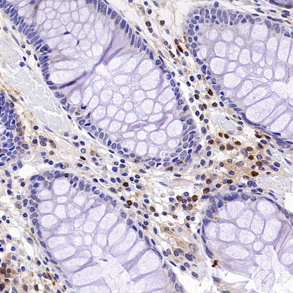 GBP5 Rabbit Polyclonal Antibody