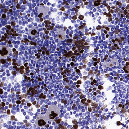 GATA1 Recombinant Rabbit mAb (S-5401)