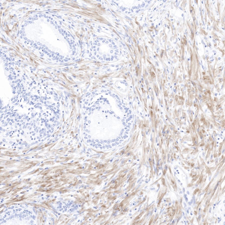 pan (alpha) actin Recombinant Rabbit mAb (SDT-044-17)
