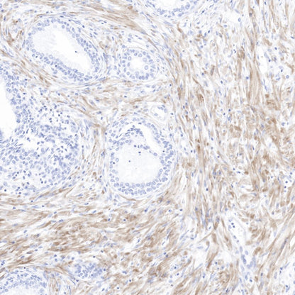 pan (alpha) actin Recombinant Rabbit mAb (SDT-044-17)
