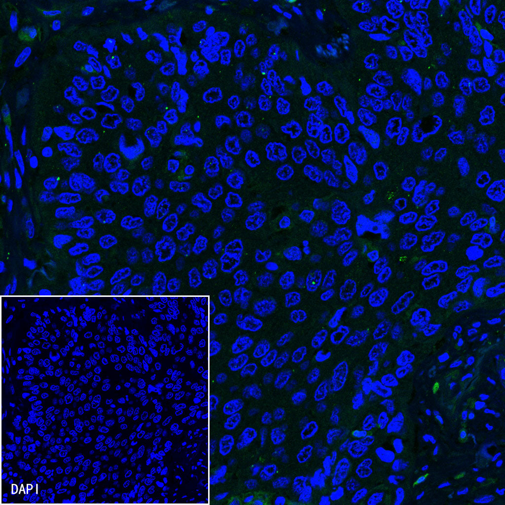Claudin18.2 Recombinant Rabbit mAb,PBS Only (SDT-102-24)