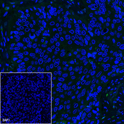 Claudin18.2 Recombinant Rabbit mAb,PBS Only (SDT-102-24)