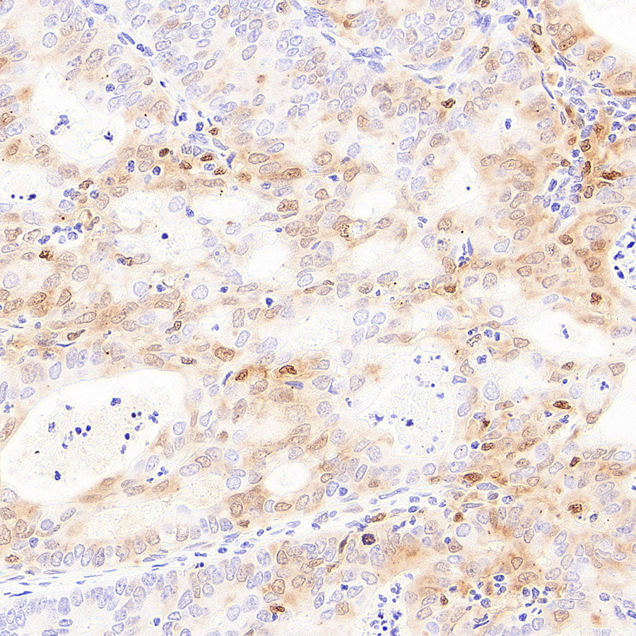Galectin-9 Recombinant Rabbit mAb (S-4579-67)