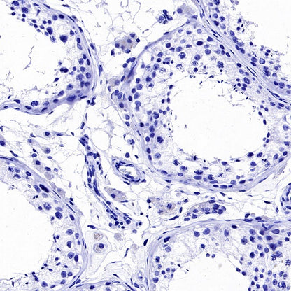 GRM5 Recombinant Rabbit mAb (SDT-2419-37)