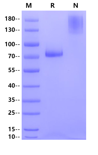 IL-17 RB Fc Chimera Protein, Human