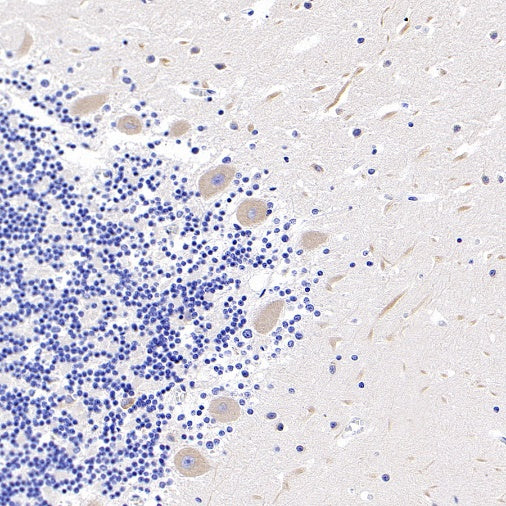 KIF3A Recombinant Rabbit mAb (S-1083-9)