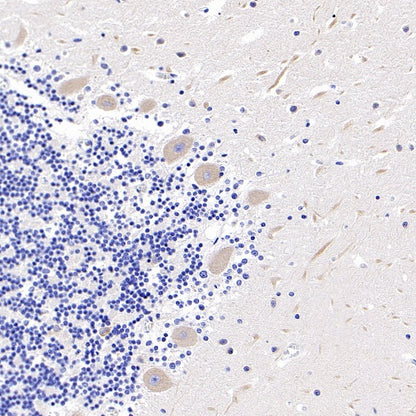 KIF3A Recombinant Rabbit mAb (S-1083-9)