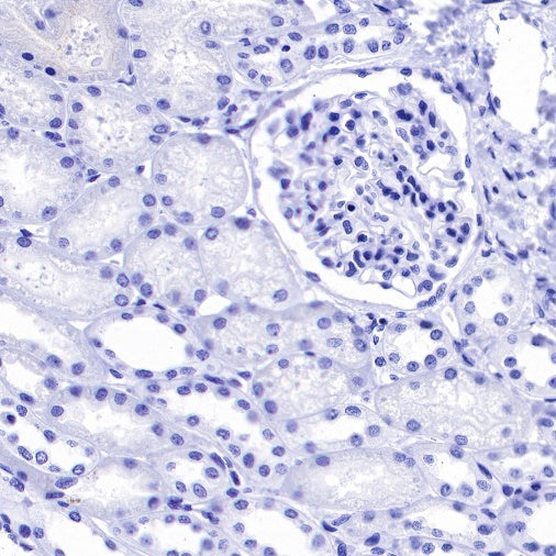Glucagon Recombinant Rabbit mAb (S-365-17)