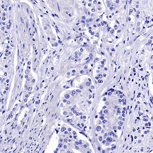Cytokeratin 6A (KRT6A) Recombinant Mouse mAb (SDT-3380)