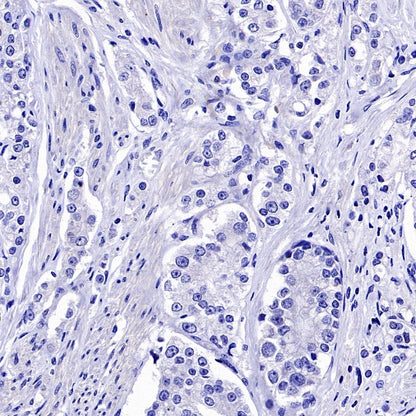 Cytokeratin 6A (KRT6A) Recombinant Mouse mAb (SDT-3380)
