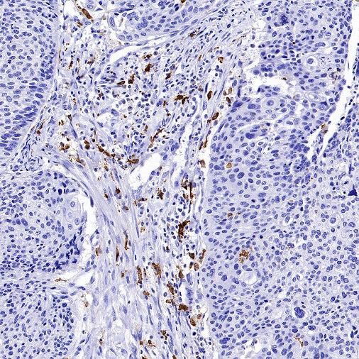 Mannose Receptor Recombinant Rabbit mAb (SDT-2206-59)