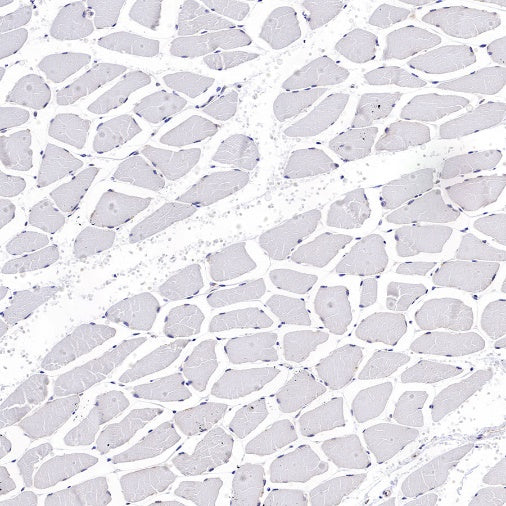 RPL26L1 Recombinant Rabbit mAb (S-R317)