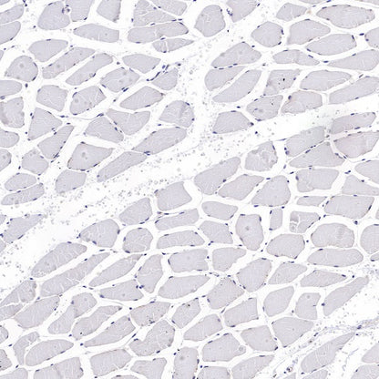 RPL26L1 Recombinant Rabbit mAb (S-R317)