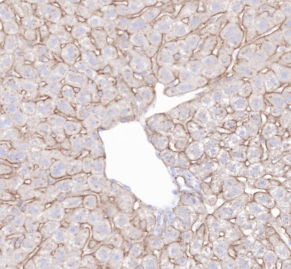 LDL receptor Recombinant Rabbit  mAb (SDT-057-57)