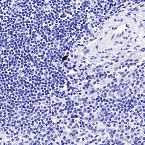 Human IgG4 Recombinant Rabbit mAb (S-1140-53)