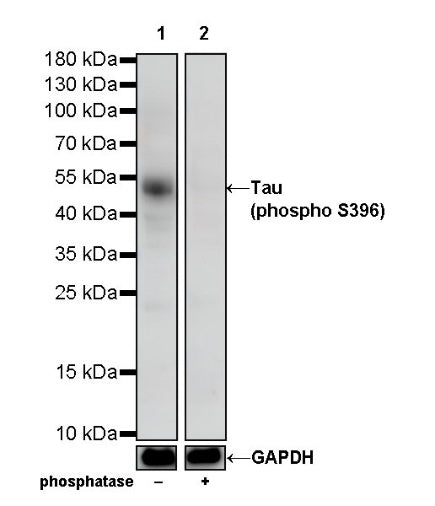 Tau (phospho S396) Recombinant Rabbit mAb (S-R276)