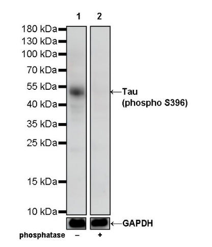 Tau (phospho S396) Recombinant Rabbit mAb (S-R276)