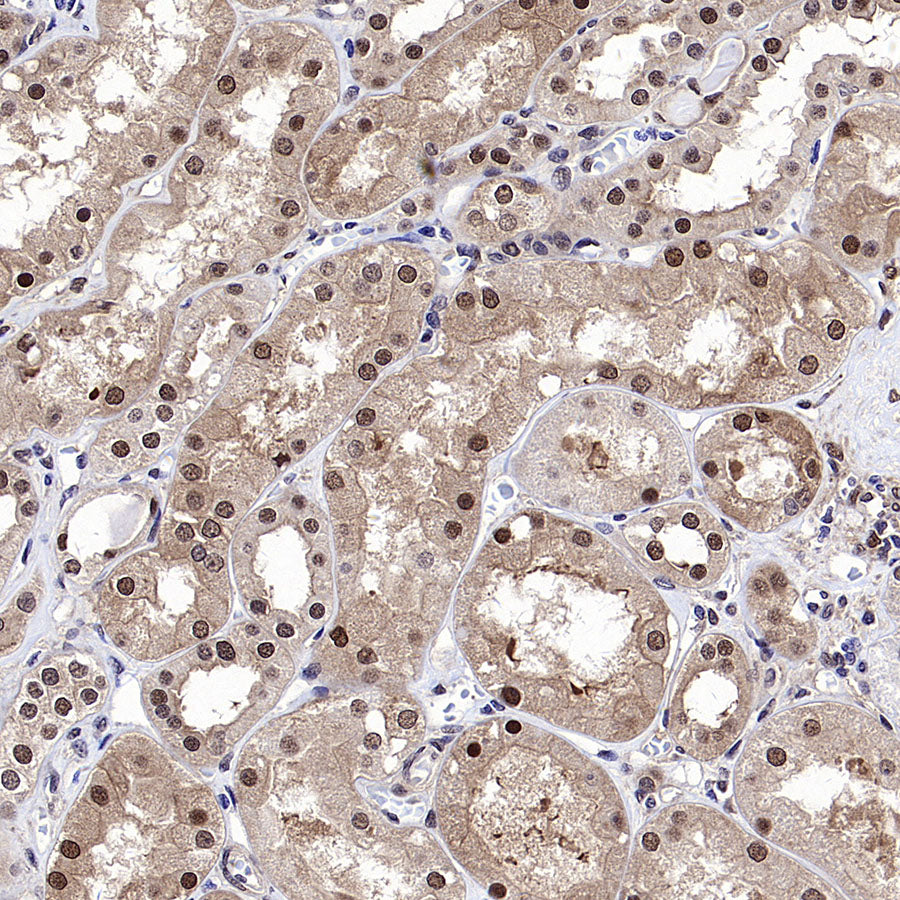 DCAF8 Recombinant Rabbit mAb (S-3483-11)