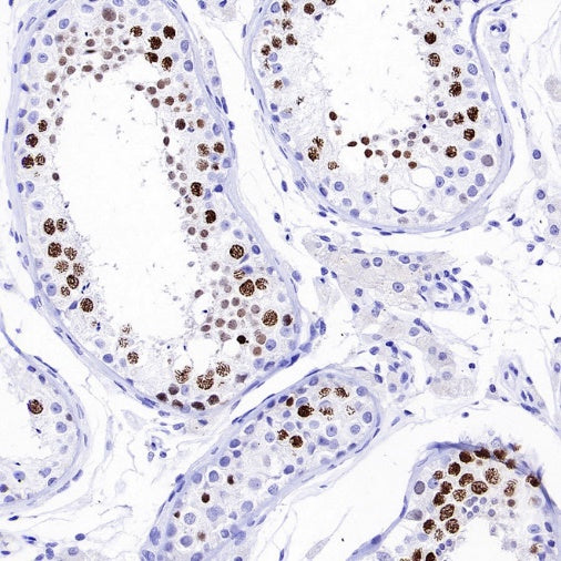 TOP2A Recombinant Rabbit mAb (S-513-107)