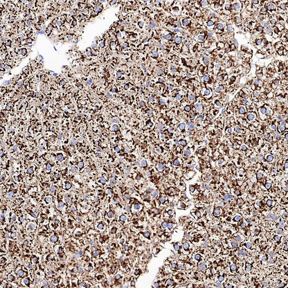 Sec61B Recombinant Rabbit mAb (S-4499-3)