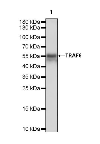 TRAF6 Recombinant Rabbit mAb (S-1087-44)