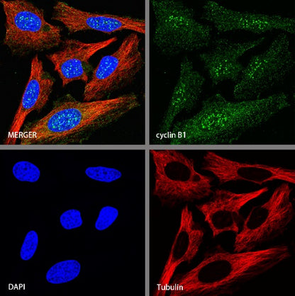Cyclin B1 Recombinant Rabbit mAb (S-1407-224)