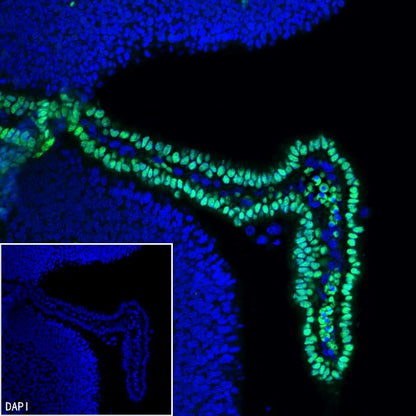 OTX2 Recombinant Rabbit mAb (S-2095-8)