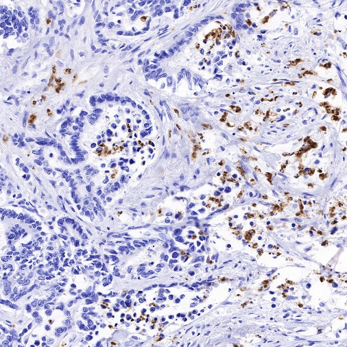 Arginase-1 Recombinant Rabbit mAb (SDT-369-33)